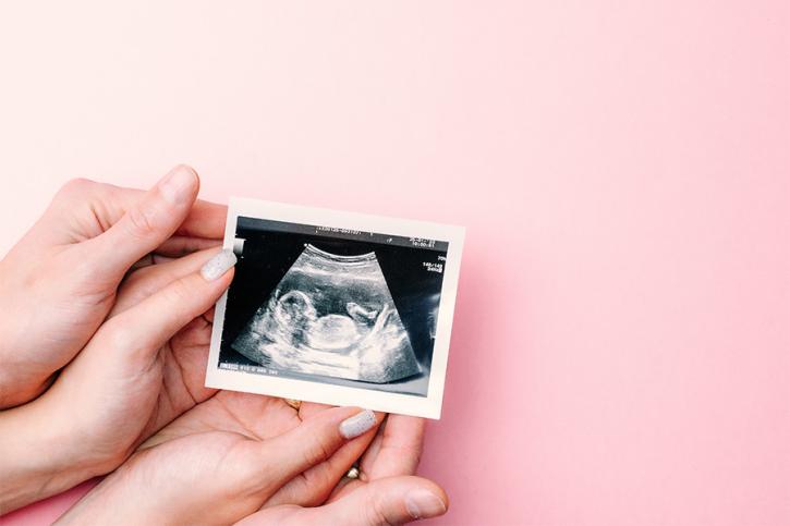 Ultrasound Image